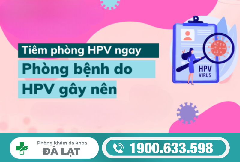 Hình ảnh minh họa